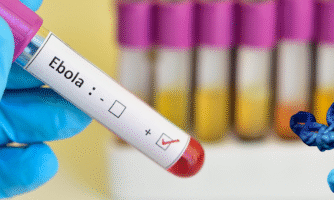 EBOLA RESPONSE MUST PROTECT LIVES WITHOUT SACRIFICING HUMAN RIGHTS